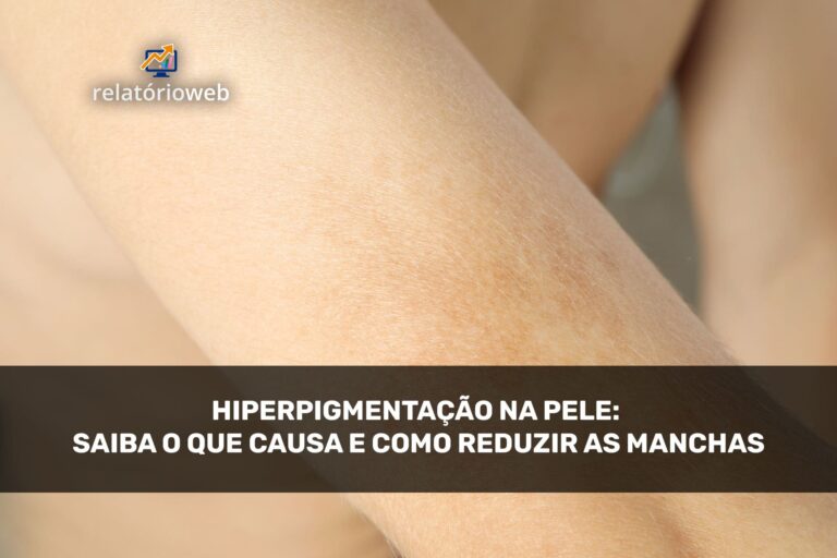 hiperpigmentacao-na-pele